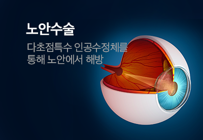 노안교정