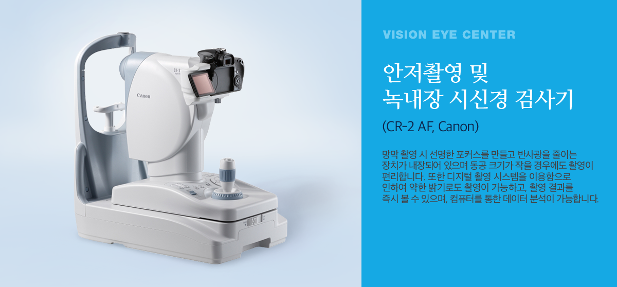안저촬영 및 녹내장 시신경 검사기